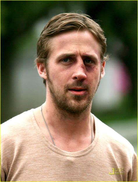 Ryan Gosling Gets A Black Eye Photo 1906891 Photos Just Jared