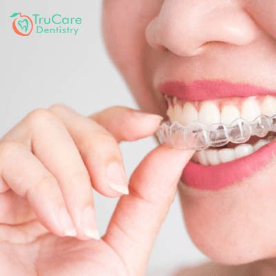 They may look like their stuff to customize your teeth. How long does Invisalign take to make your teeth beautiful ...