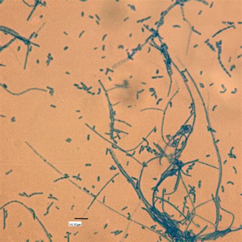 Hyaline Septate Hyphae With Chains Of Arthro Conidia And Sessile