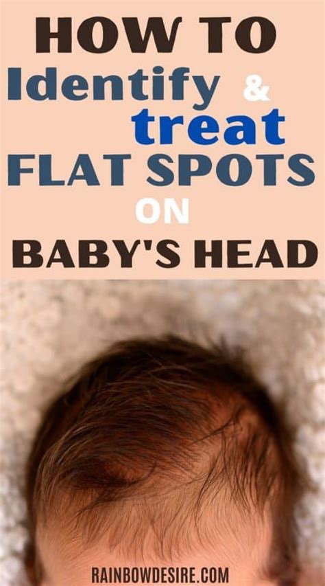 Flat Head Syndrome In Babies How To Identify Flat Spots On Babys