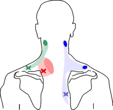 What Causes Neck Pain On The Left Side
