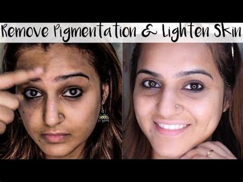 💜 tags to make this video more searchable (please ignore): How to Get Rid of Pigmentation, Dark Spots, Discoloration ...