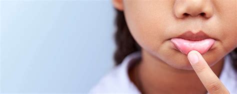 Mouth Ulcers In Kids Causes And Prevention Zendium