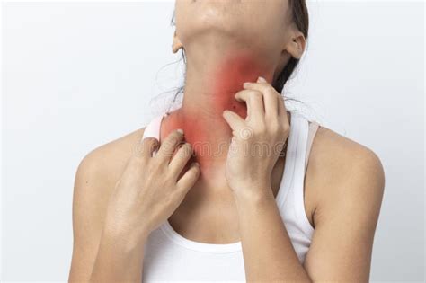 Asian Young Woman Itchy Skin Scratching Her Neck Isolated On White Background Stock Image