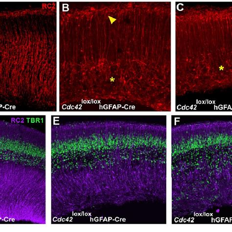 Disrupted Radial Glial Development In Cdc42 Loxlox Hgfap Cre Cerebral