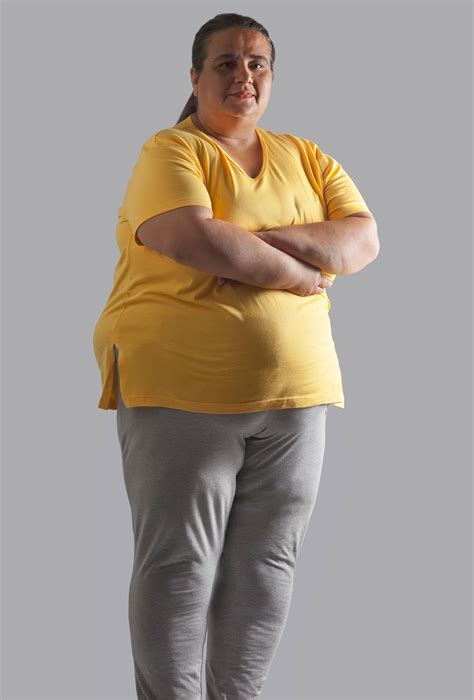 Its Time To End The Stigma Of Obesity Idea Health And Fitness Association
