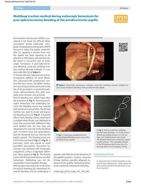 Pdf Multiloop Traction Method During Endoscopic Hemostasis For Post