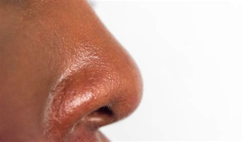 Oily Nose Causes And How To Get Rid Of It And Tiege Hanley