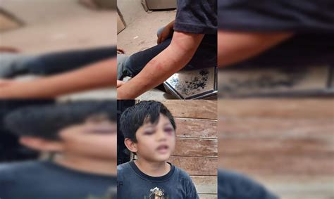 Pasa En México Padrastro Golpea Brutalmente A Niño Porque No Podía Leer