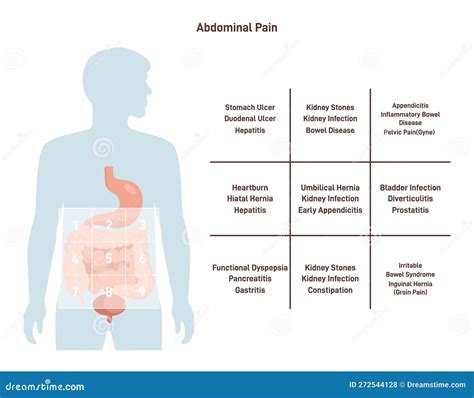 Abdominal Ache Map Medical Infographic Or Self Help Guide Stock Vector