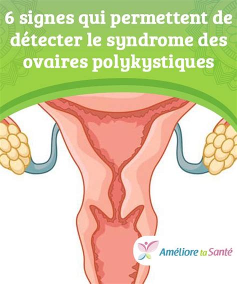 Signes Qui Permettent De D Tecter Le Syndrome Des Ovaires
