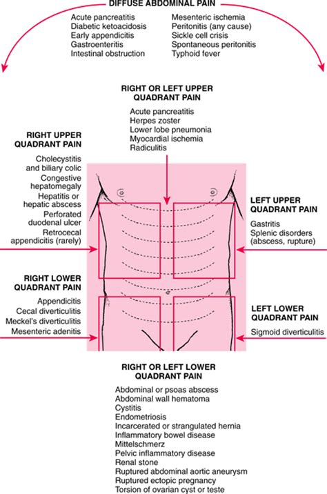 Stomach Ulcer Pain Quadrant