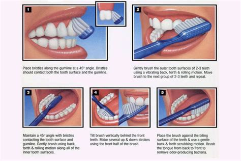 Proper Brushing Dr Pradnya Rivankar Perfect Smile Dental Clinic In