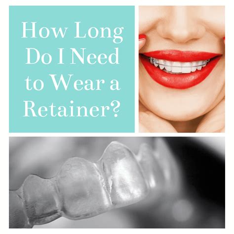Data on file at align technology, as of september 9, 2020. How Long Do I Need to Wear a Retainer?
