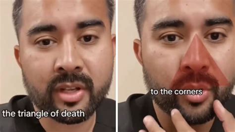 Popping Pimples Tiktok Doctor Warns Of ‘triangle Of Death The Mercury