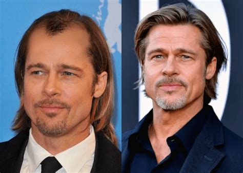 Male Celebrities Wearing Toupees Due To Hair Loss Newtimeshair