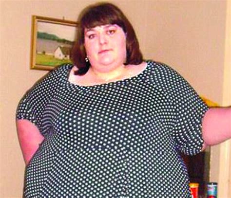 How Britains Fattest Woman Lost 18 Stone The Asian Age Online Bangladesh