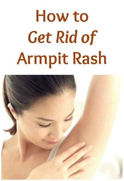 You Can Heal Armpit Rash With Home Remedies If You Are Confident As To
