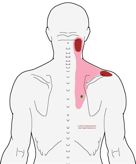 Referral Trapezius Lower T7 Trigger Points Trigger Points Neck