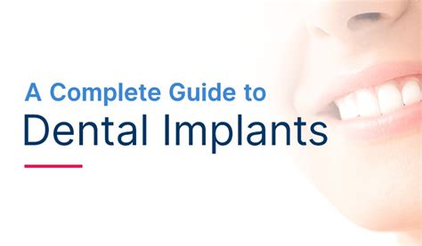 The Ultimate Guide To Dental Implants Sugar Land Dental Lounge