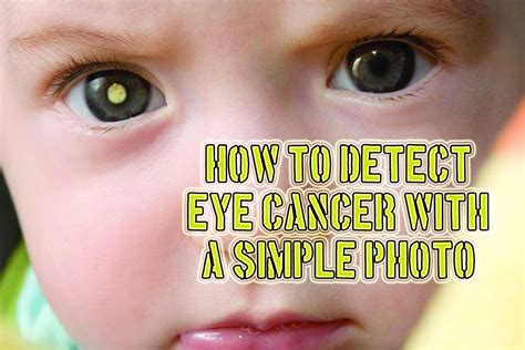 Neither it is a standard answer as there are a large array of tests available to facilitate the process. How to Detect Eye Cancer With A Simple Photo - YouTube