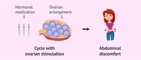 Discomfort From Ovarian Stimulation