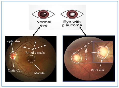 Applied Sciences Free Full Text Deep Learning For Optic Disc