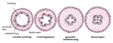 Related online courses on physioplus. Medicijnvrije behandeling van COPD - Zoutkamer Veenendaal ...
