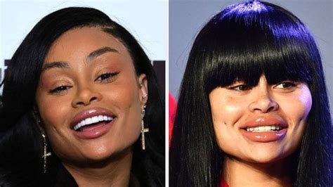 blac chyna plastic surgery before and after photos