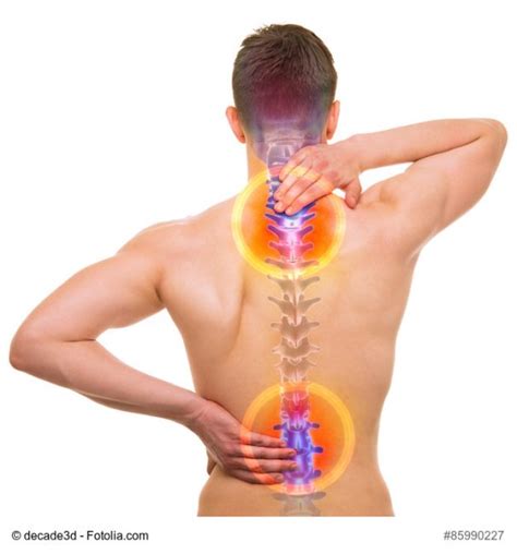 Treating A Pinched Nerve Spine And Scoliosis Specialists