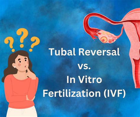 Tubal Reversal Vs IVF What Are The Best Treatment Options For Couples
