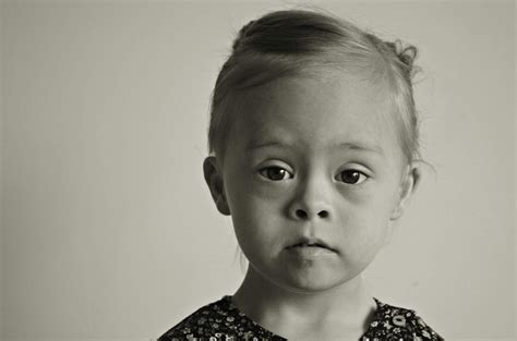 Najwięcej Fotografówjest Wśród Rodziców Dzieci Z Zespołem Downa
