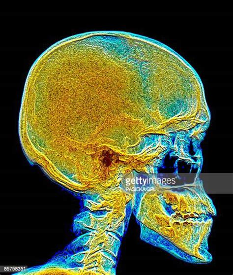 Fake Human Skull Photos And Premium High Res Pictures Getty Images