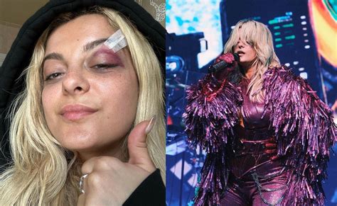 video bebe rexha hit in face with phone thrown by fan while performing on stage