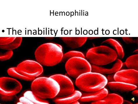 Ppt Hemophilia Powerpoint Presentation Free Download Id6197265