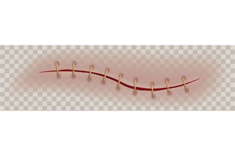 Realistic Scar Or Wound Bloody Surgical Sutures Healing Stitch Stitc