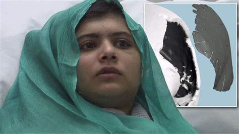 Malala Shot Teens Surgery Successful Uk News Sky News
