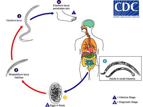 Hookworm Infection Symptoms Diagnosis And Hookworm Treatment In Humans