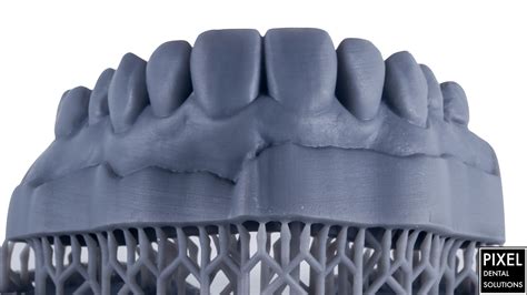 3d Printed Dental Model Per Arch Pixel Dental Solutions Singapore