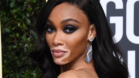 The Untold Truth Of Winnie Harlow
