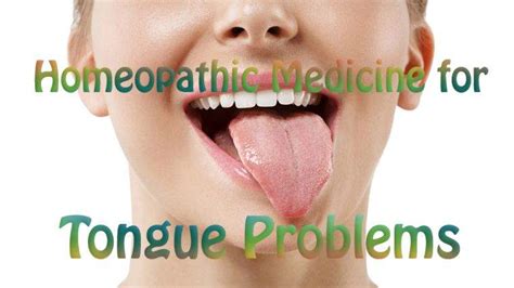 Homeopathic Medicine For Tongue Problems Homeopathic Medicine And