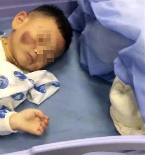 2岁男童疑遭虐打 因伤情过于严重离开人世香港