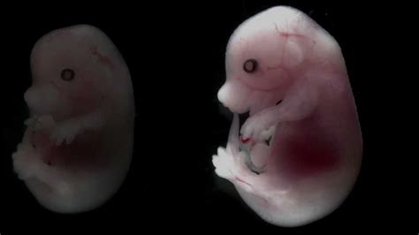 Mouse embryo developing over time - YouTube