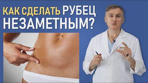После удаления селезенки диета