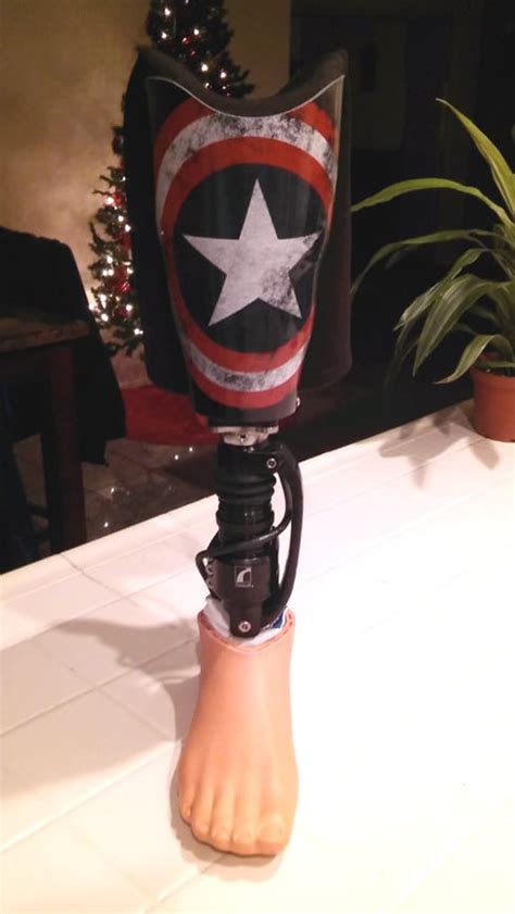 Captain America Prosthetic Leg Evolve Prosthetics And Orthotics