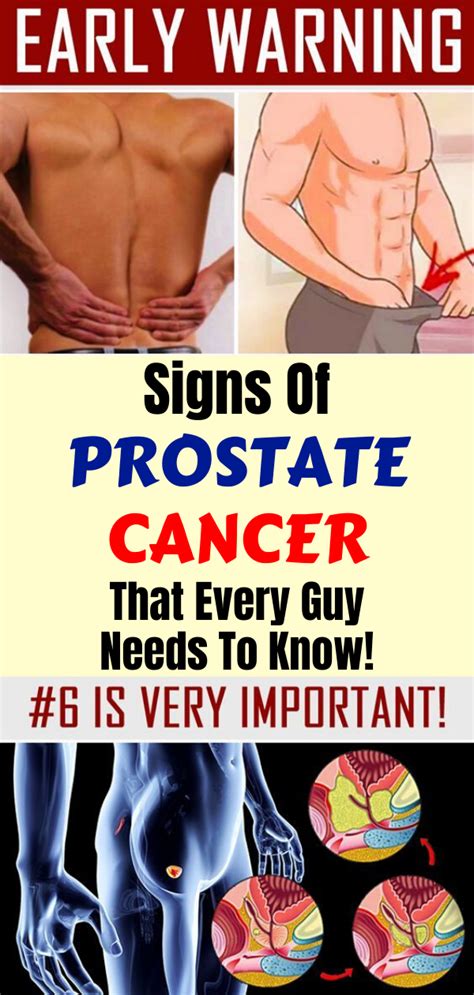 12 early warning signs of prostate cancer that every guy needs to know holistic and healthy