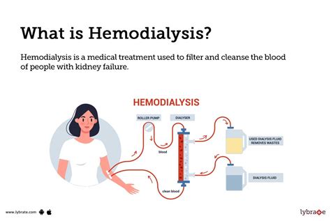 Hemodialysis Causes Symptoms Treatment And Cost