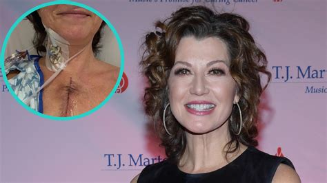 Amy Grant Gets Sudden Open Heart Surgery And Shares First Scar Photos