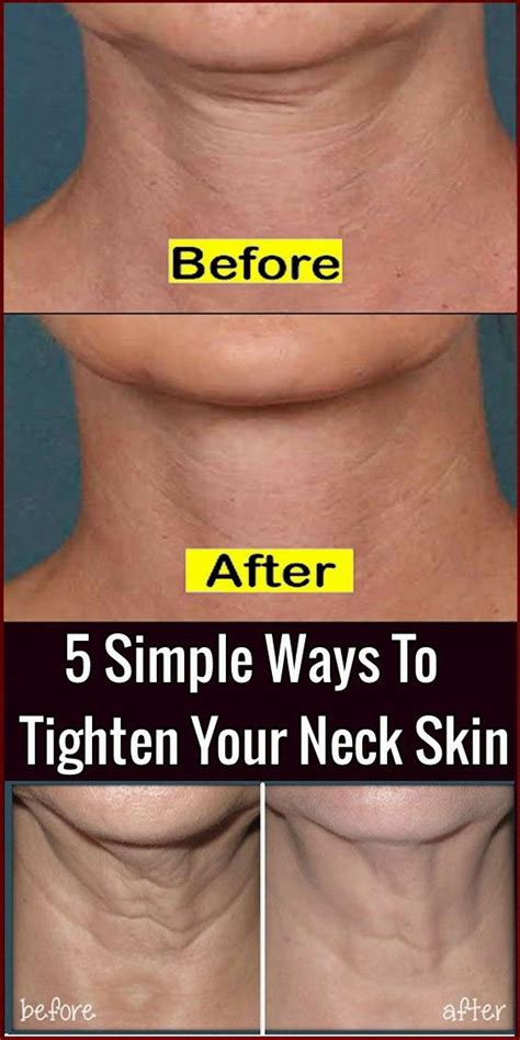 How To Tighten Skin The Ultimate Guide Ihsanpedia