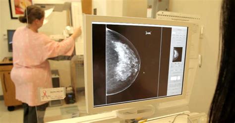 New Guidelines Recommend Less Frequent Mammograms For Some Women Cbs News
